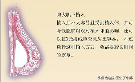 18岁女可以练胸吗,基础太差做胸部整形