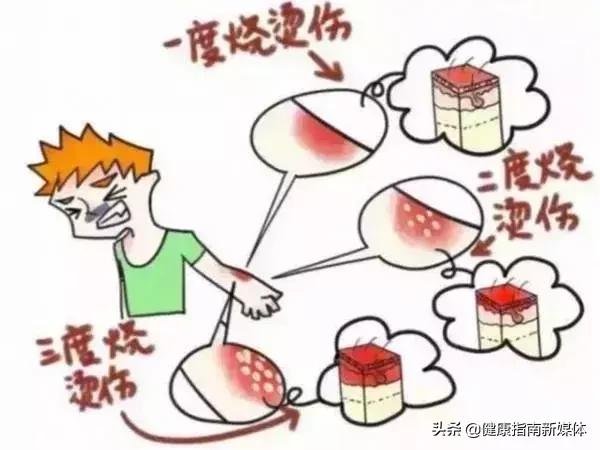 烧烫伤应急处理视频,烧烫伤的应急处理及预防