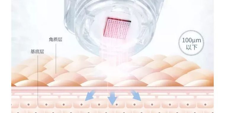 如何避免频繁戴口罩引起皮肤问题,戴口罩后护肤注意什么