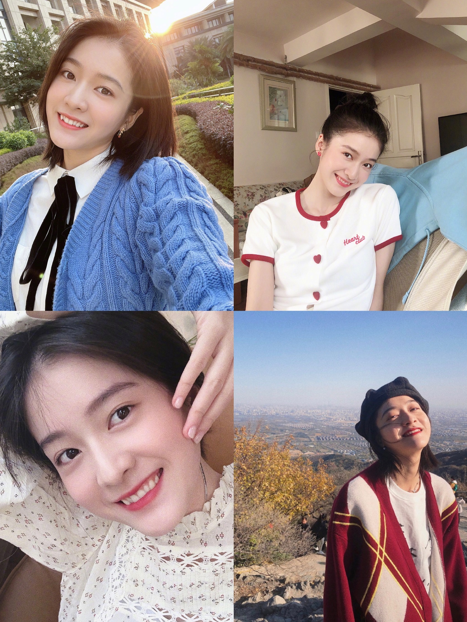 娜扎整牙后的样子,娜扎整牙前照片