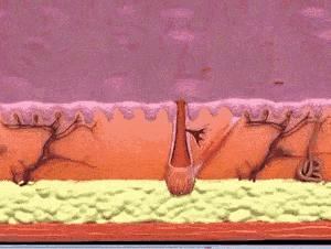 果酸精华改善鸡皮肤,医院果酸换肤鸡皮肤能用吗