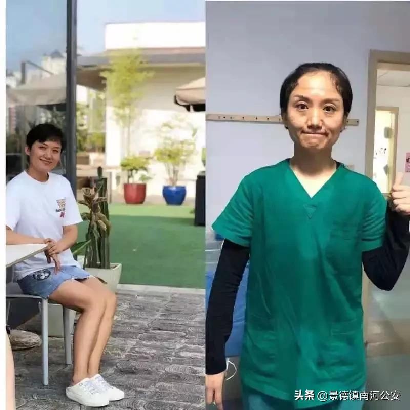 女医护脸上勒痕,最美护士脸上勒痕