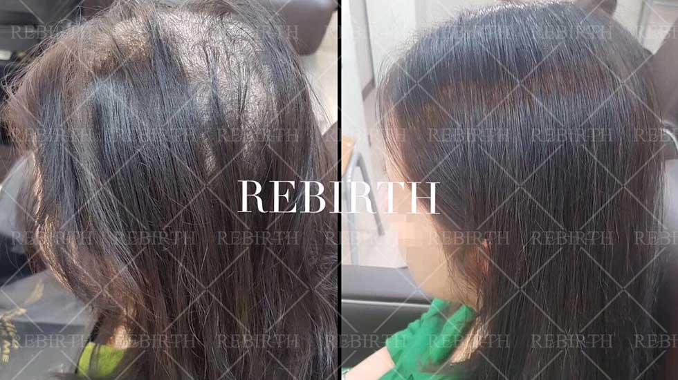 轻丝增发跟物理增发有啥区别,丽碧丝增发效果如何