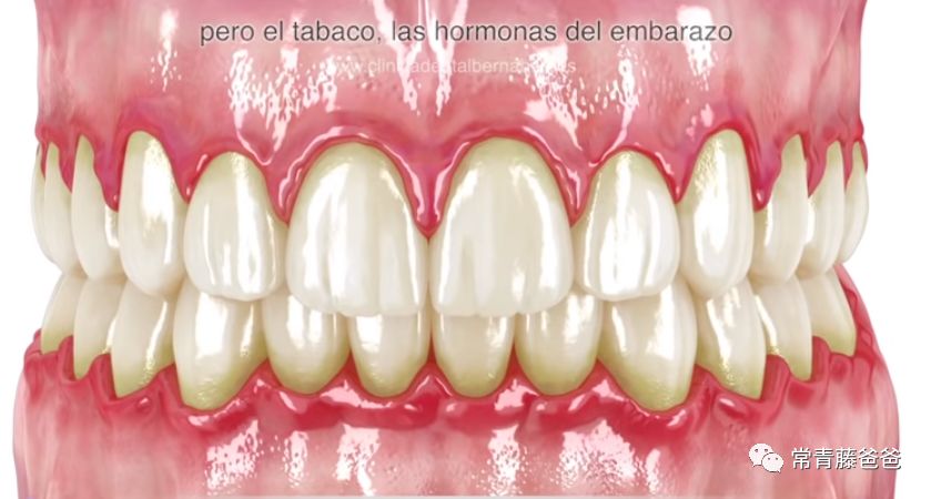 爱牙日保护你的口腔健康,爱牙日从定期口腔检查开始