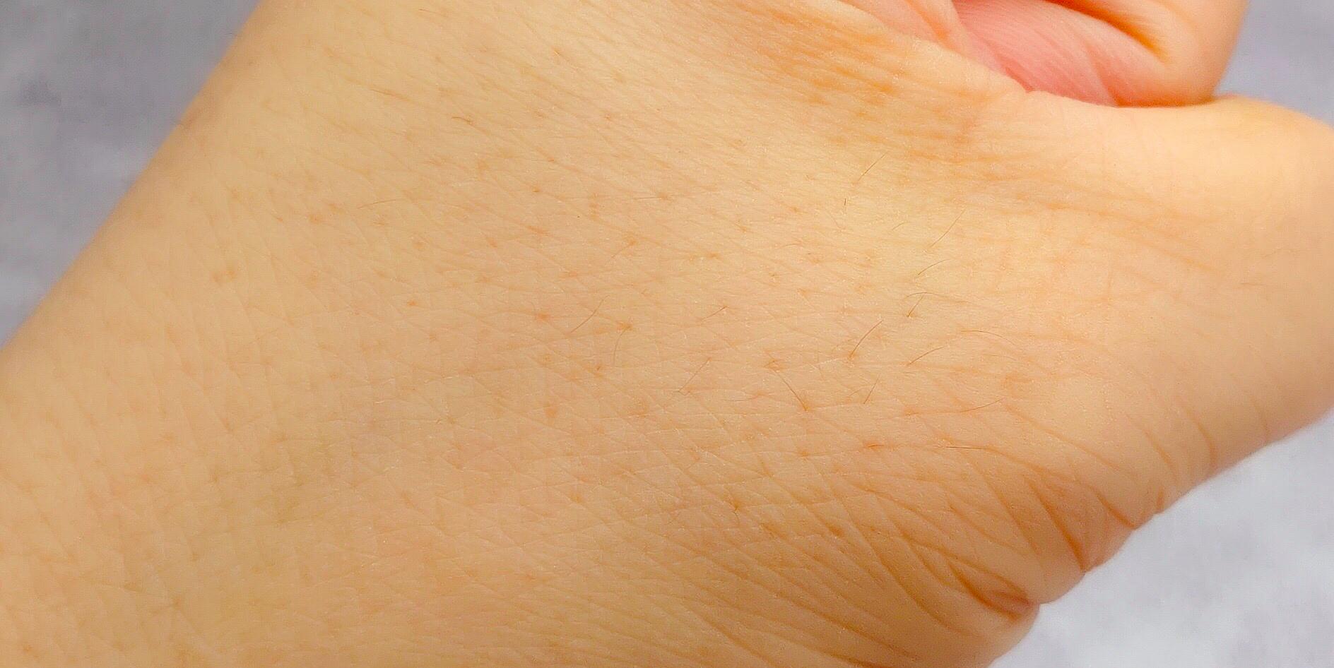 ulike脱毛仪多少钱一台,ulikerose脱毛仪