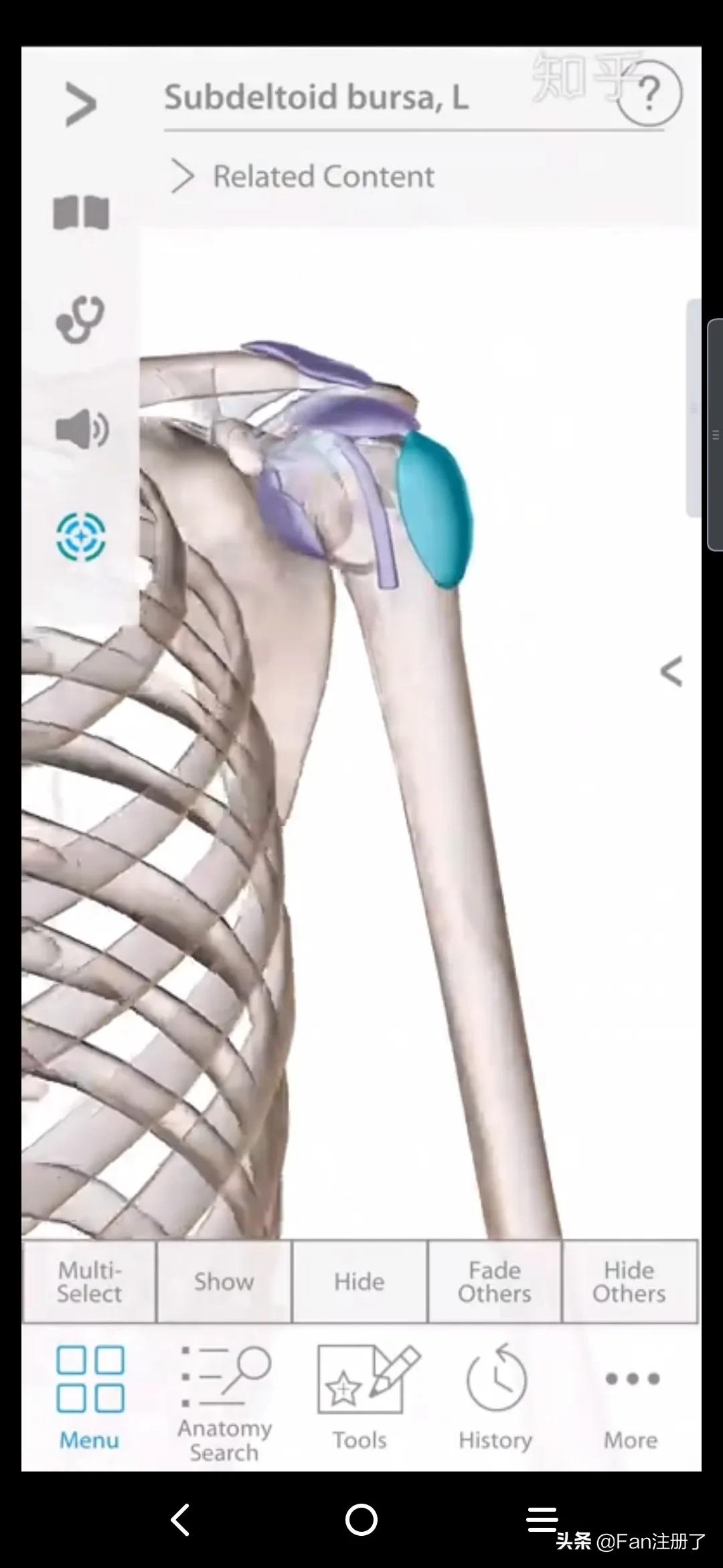 鑲╁嘲涓嬫粦鍥婄値鐥呭洜,鑲╁嘲婊戝泭鐐庝綅缃浘