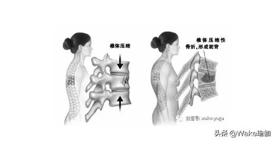 三个动作帮忙解决含胸驼背,3个动作纠正驼背挺拔身姿