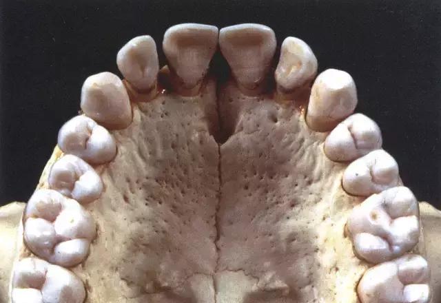 什么牙齿颜色是正常的,什么样的牙齿有特殊作用