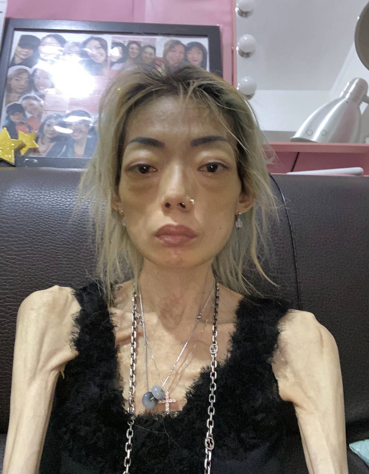 嫁给一个富裕家庭8年后他瘦到了44磅武志恒被赶出家门经历了什么