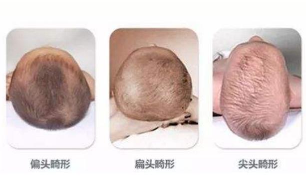 新生儿宝宝怎么睡头型好看,新生儿头型睡偏了怎么纠正