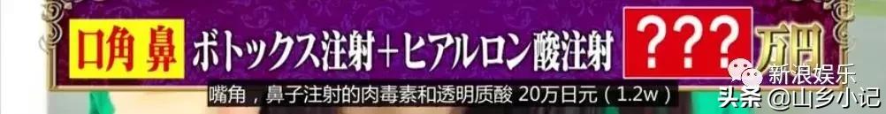 明明是整容脸现在却成了颜值巅峰,明明是整容脸却没被吐槽过