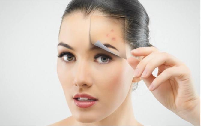 脸上有痘印该用去痘印精华吗,反复起痘有痘印应该用什么精华