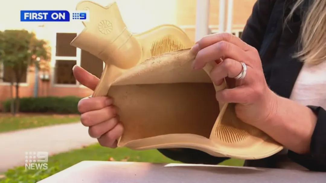 热水袋低温烫伤造成截肢,热水袋烫伤植皮疼吗