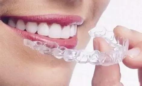 十个牙齿矫正的误区,矫正牙齿的十个误区