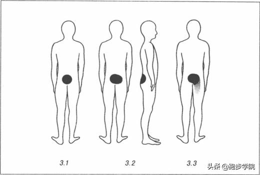 腰椎间盘突出跑步好还是跳绳好,腰椎间盘4-5节突出可以跑步吗