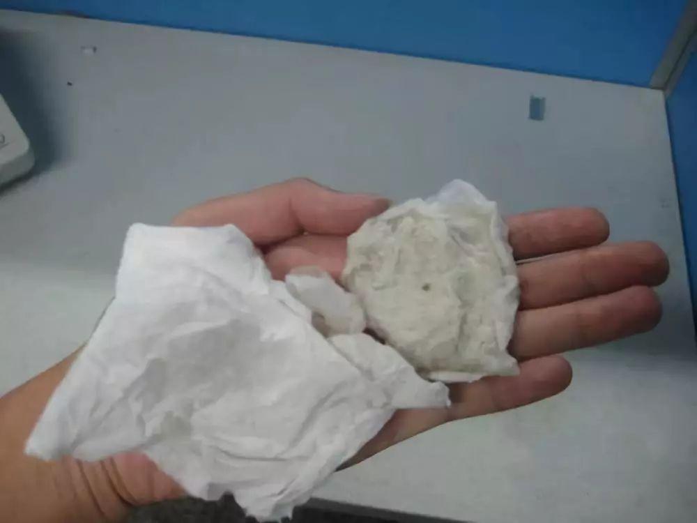 宝宝用湿巾擦屁股的正确方法,为什么用湿巾给宝宝擦屁股会红