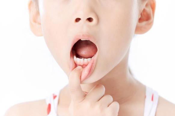 提醒家长关注幼儿换牙问题,换牙期父母要知道的