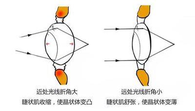 经常眯眼睛看东西眼睛会变小吗,为什么老是眯眼