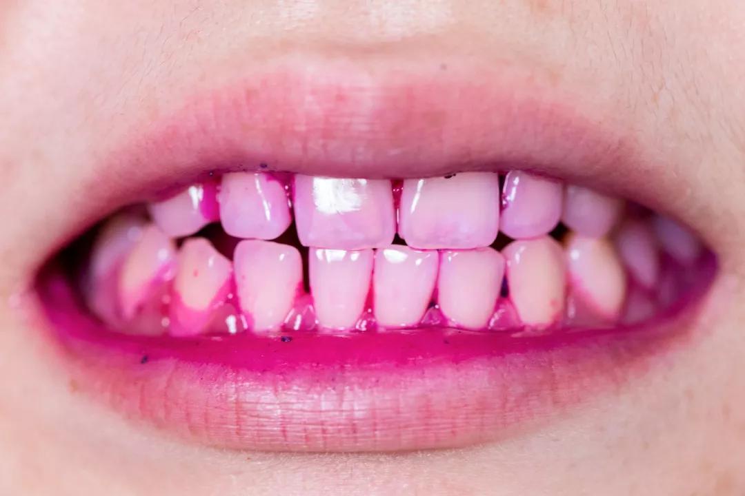 护牙釉质的牙膏叫什么牙膏,防蛀牙牙膏推荐前十名儿童