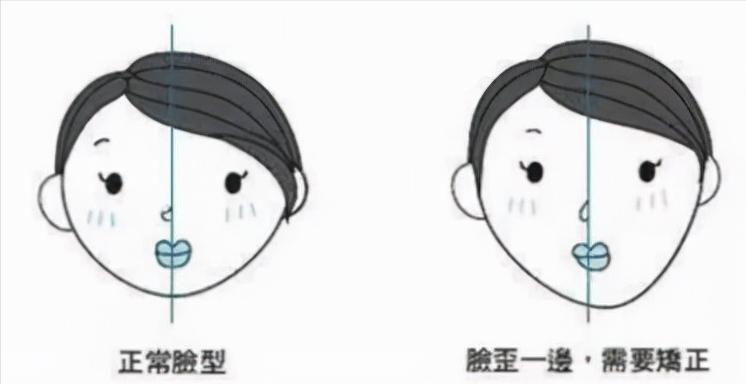 缺牙长期一侧咀嚼嘴巴倾斜,缺牙对咀嚼的影响