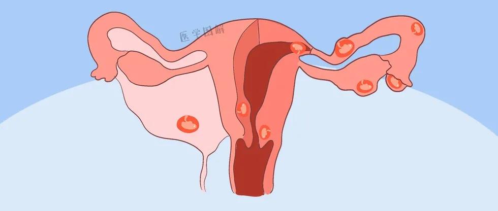 妊娠管理和妊娠诊断,妊娠合并的患者正确的护理措施