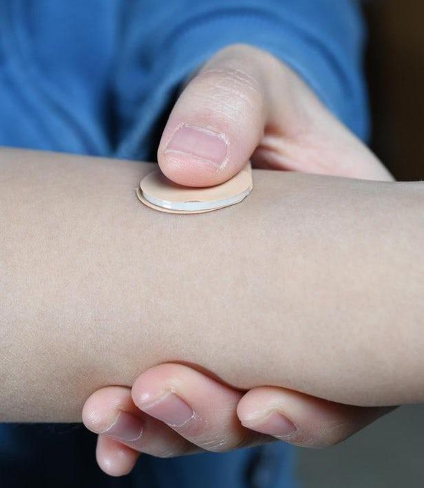 无痛微针贴片,避孕贴片三个月