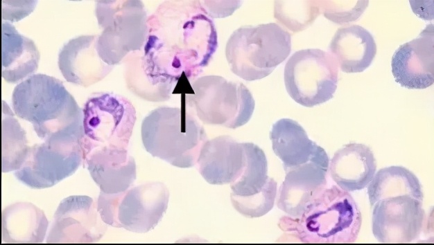 检查身体有没有虫怎么检查,身上有小黑点点一样的虫子