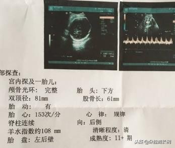 b超单显示后壁是前怀还是后怀,b超单上写了前壁是什么意思