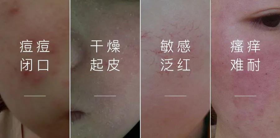 美容护肤界的万金油积雪草,积雪草在护肤界有万金油之称