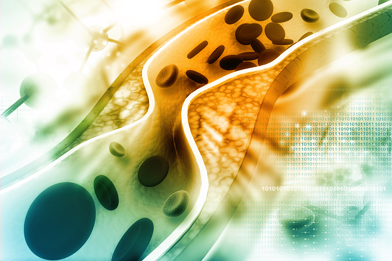 血管堵塞通后导致血管爆裂,血管堵塞会引起血管爆裂吗