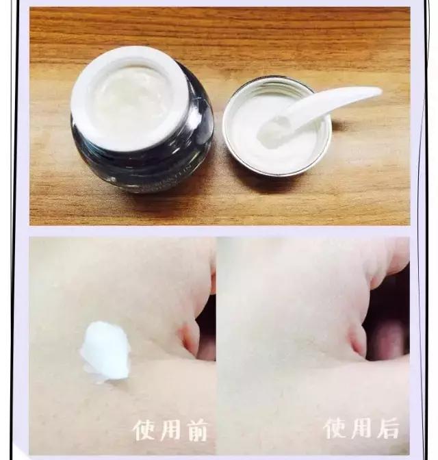 保养从来就不是一件小事，抗衰老一定要趁早