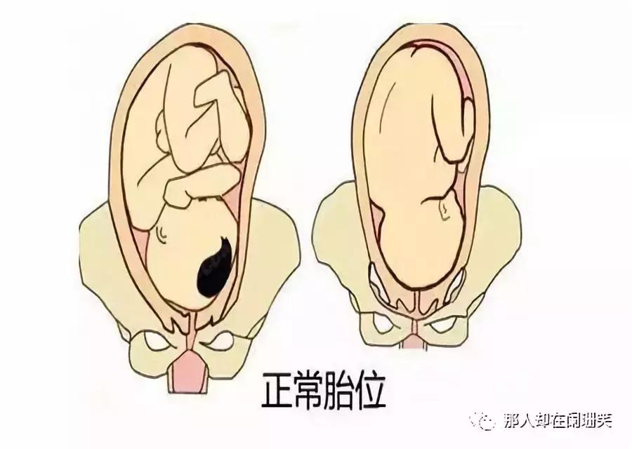 胎儿臀位最晚什么时候能转为头位,胎儿头位和横位有什么区别