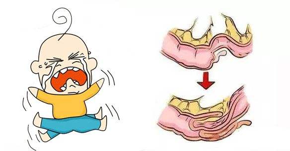 婴儿洗完澡身上总有臭味,8岁的女宝有体臭怎么办