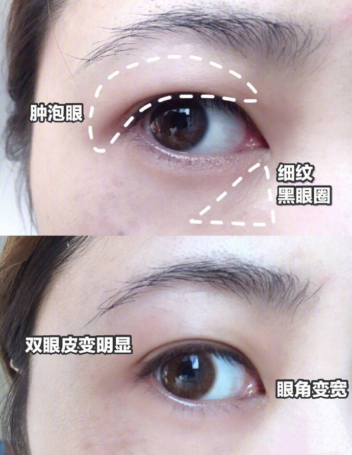 三分钟帮你解决眼袋黑眼圈眼纹,眼部护理告别黑眼圈眼袋眼纹