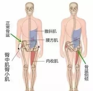 为什么拄拐杖会长短腿,天生的长短腿怎么办
