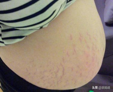 孕期注意事项大全孕妈妈值得收藏,怀孕不注意这些