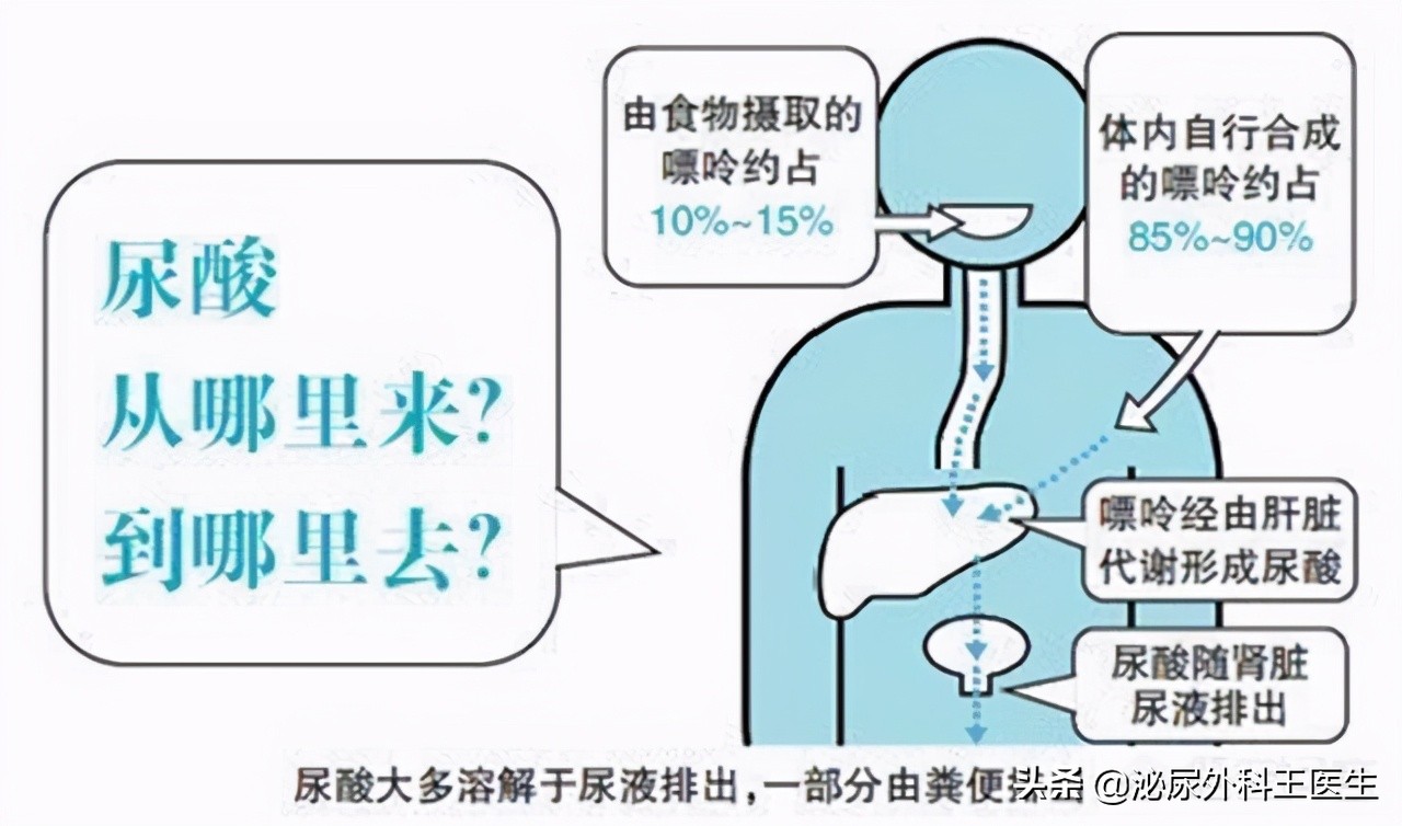 尿酸高有什么方法将尿酸降下来,尿酸升高了怎么办教你5招降尿酸