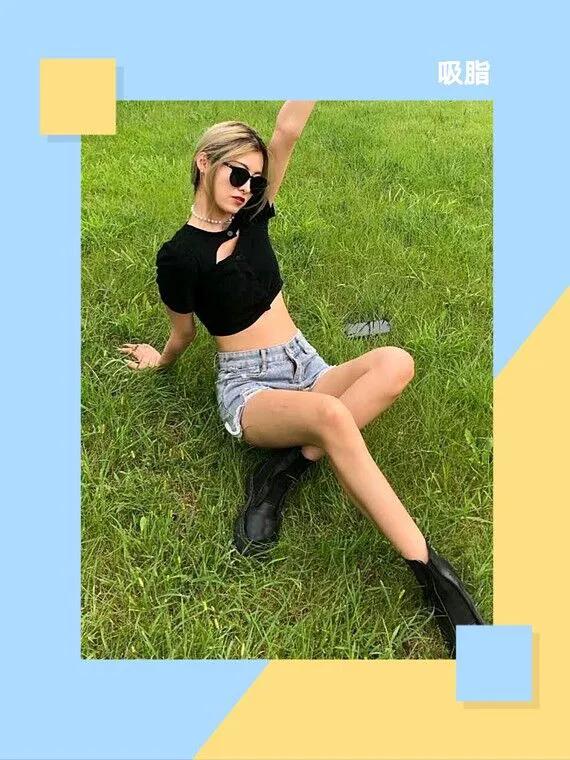 吸脂前后注意事项及禁忌,腰腹吸脂1到30天恢复图片