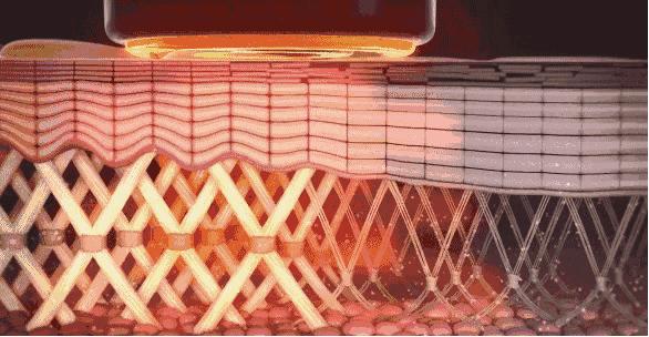 做美容的女人勇气可嘉,打了美容针的女人现在怎么样了