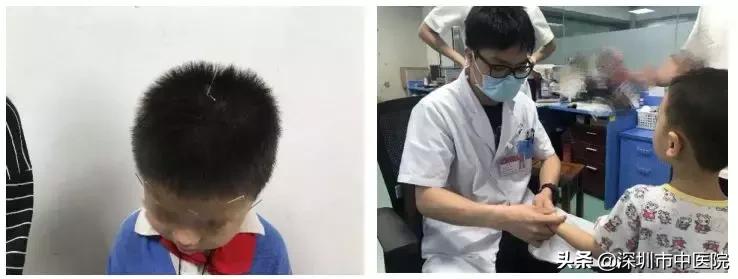 儿童多动抽动名医,中医如何治疗抽动多动