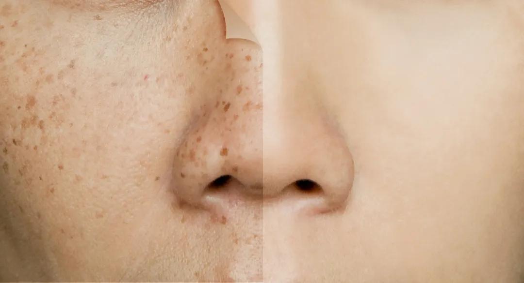 不做黄脸婆的小绝招,不做黄脸婆3招教你摆脱皮肤暗沉