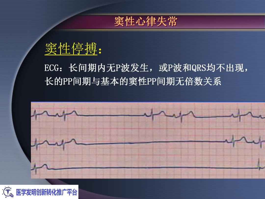 麻醉手术常见心律失常处理,麻醉引起心脏骤停原因