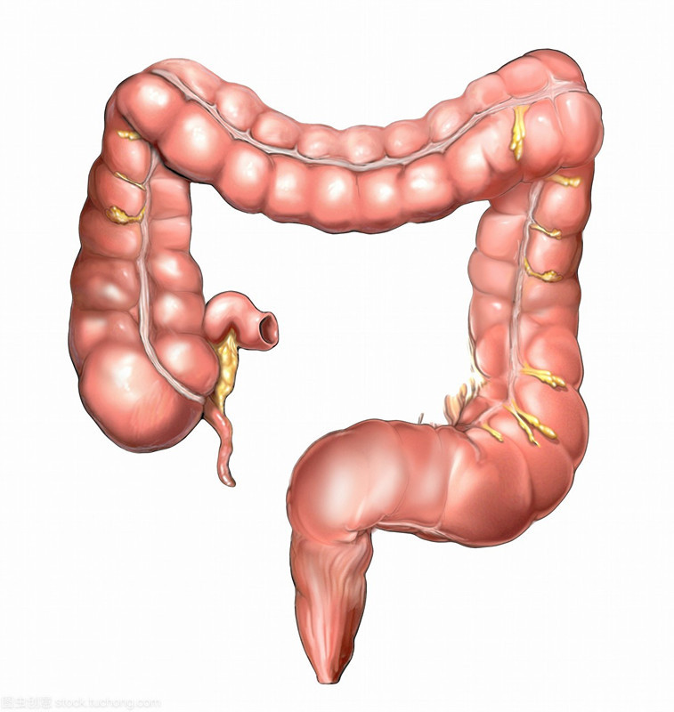 直肠癌保肛手术方案,放射治疗适合哪些直肠癌患者