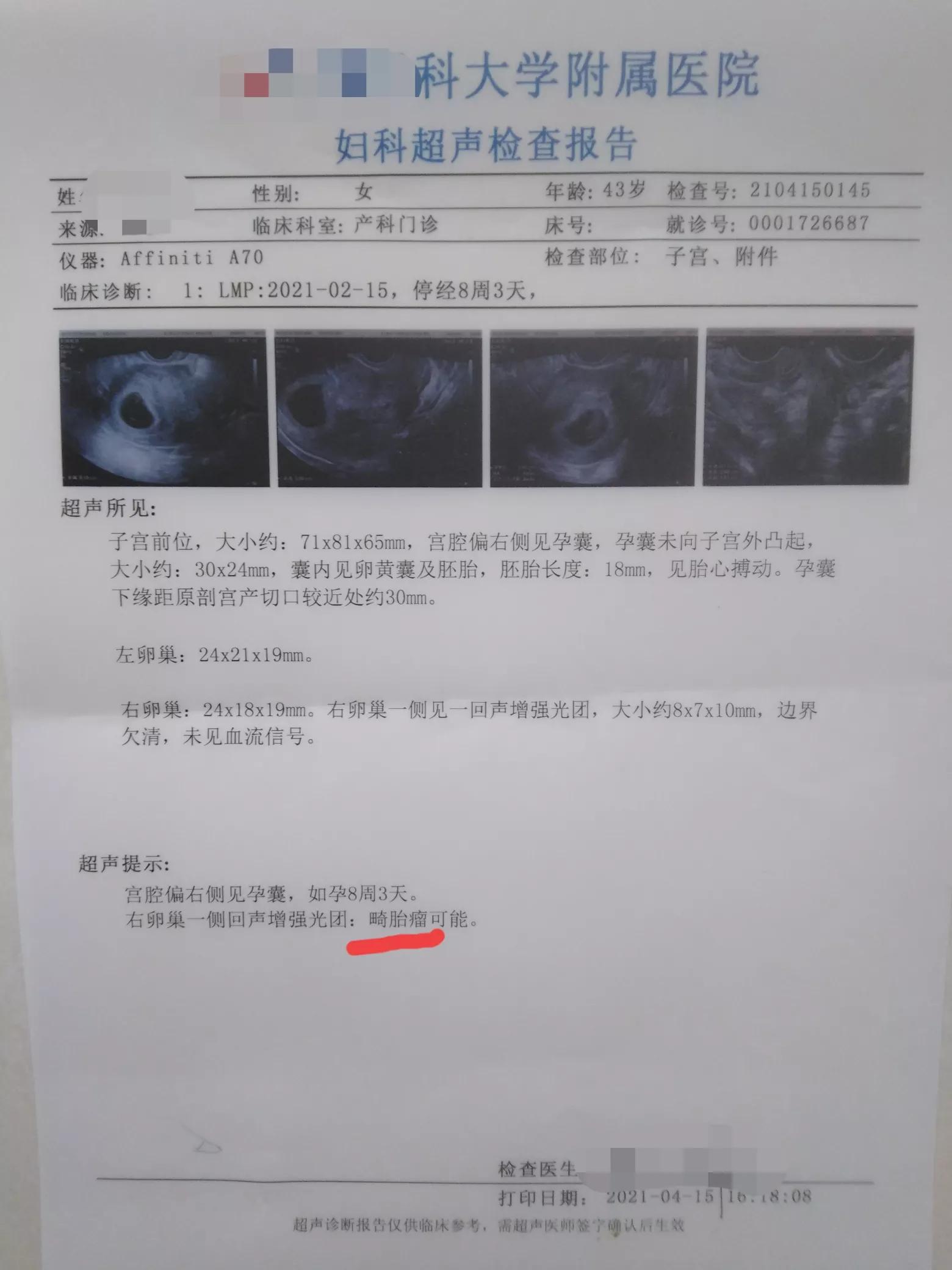 怀孕了为什么还会得胰腺癌,怀孕了为什么会得癌症