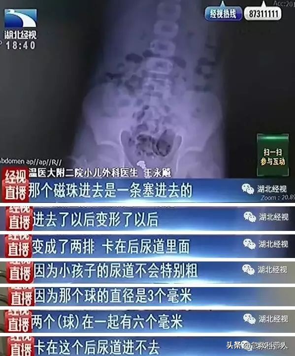 卡住食道怎么办,一个人被卡住食道怎么办