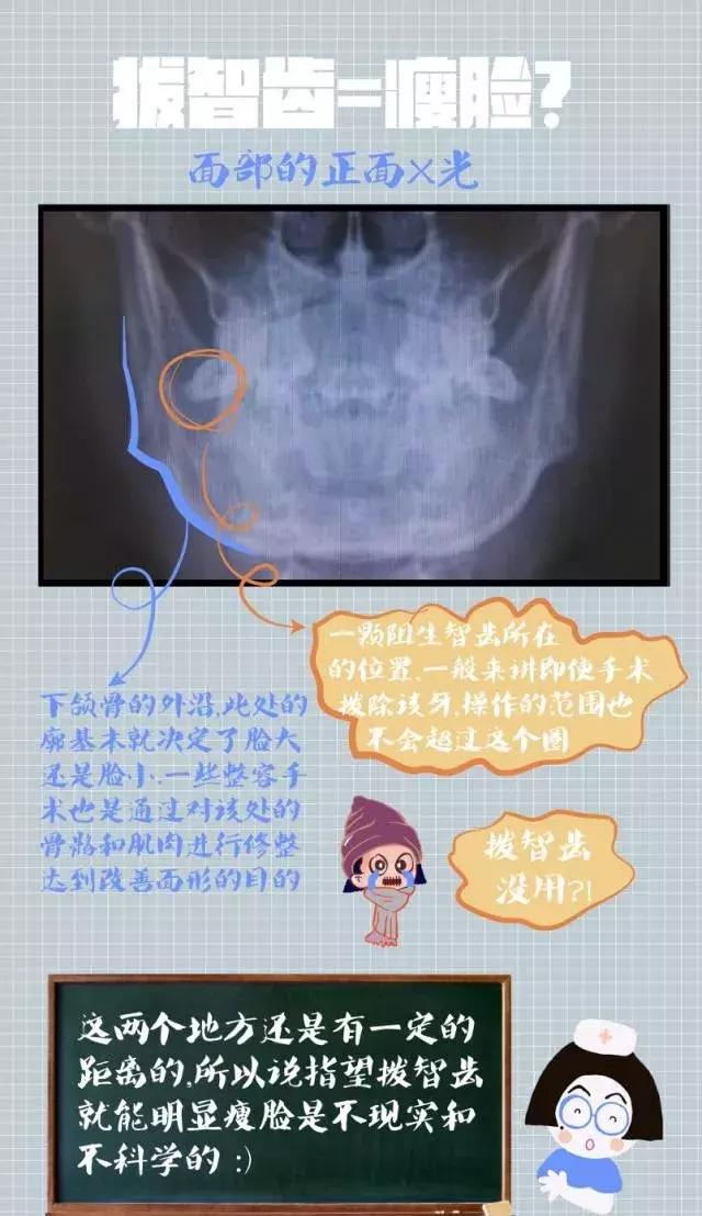 智齿神经痛怎么办,有智齿需要吃什么缓解