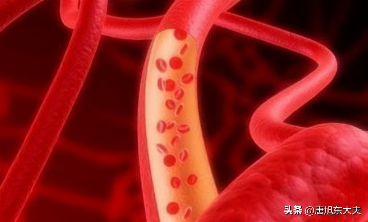 血小板比积和计数偏高有什么危害,平均血小板体积偏高有什么危害