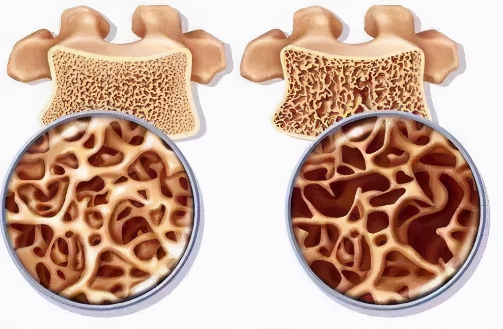 翻身疼深呼吸疼是怎么回事,向左翻身疼是怎么回事