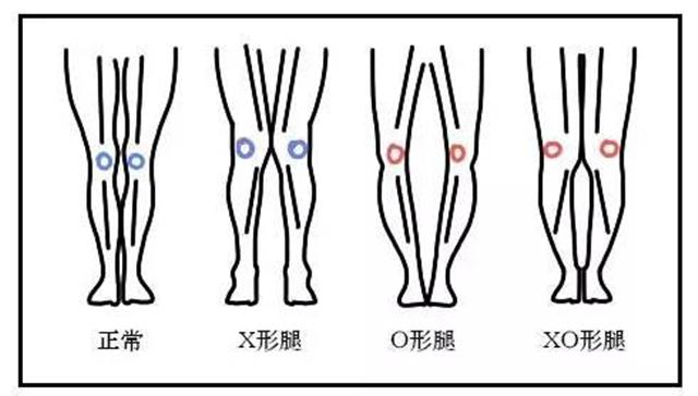 弯腿最快的方法,怎么更有效的弯腿练习
