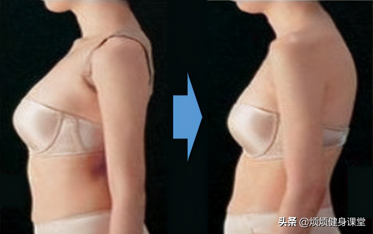 帕梅拉10分钟改善圆肩驼背,改善圆肩驼背的最有效动作